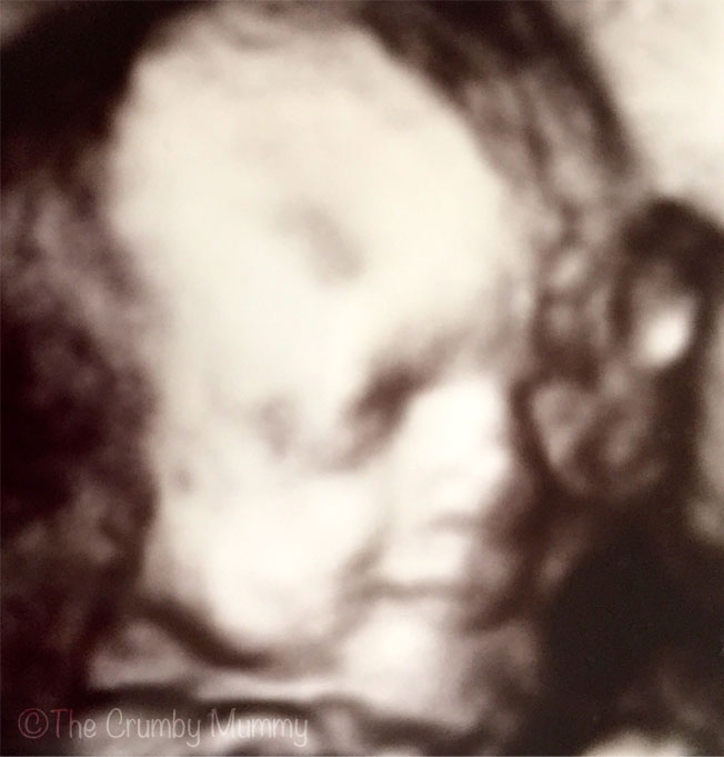 Share A Smile - 4D Scan